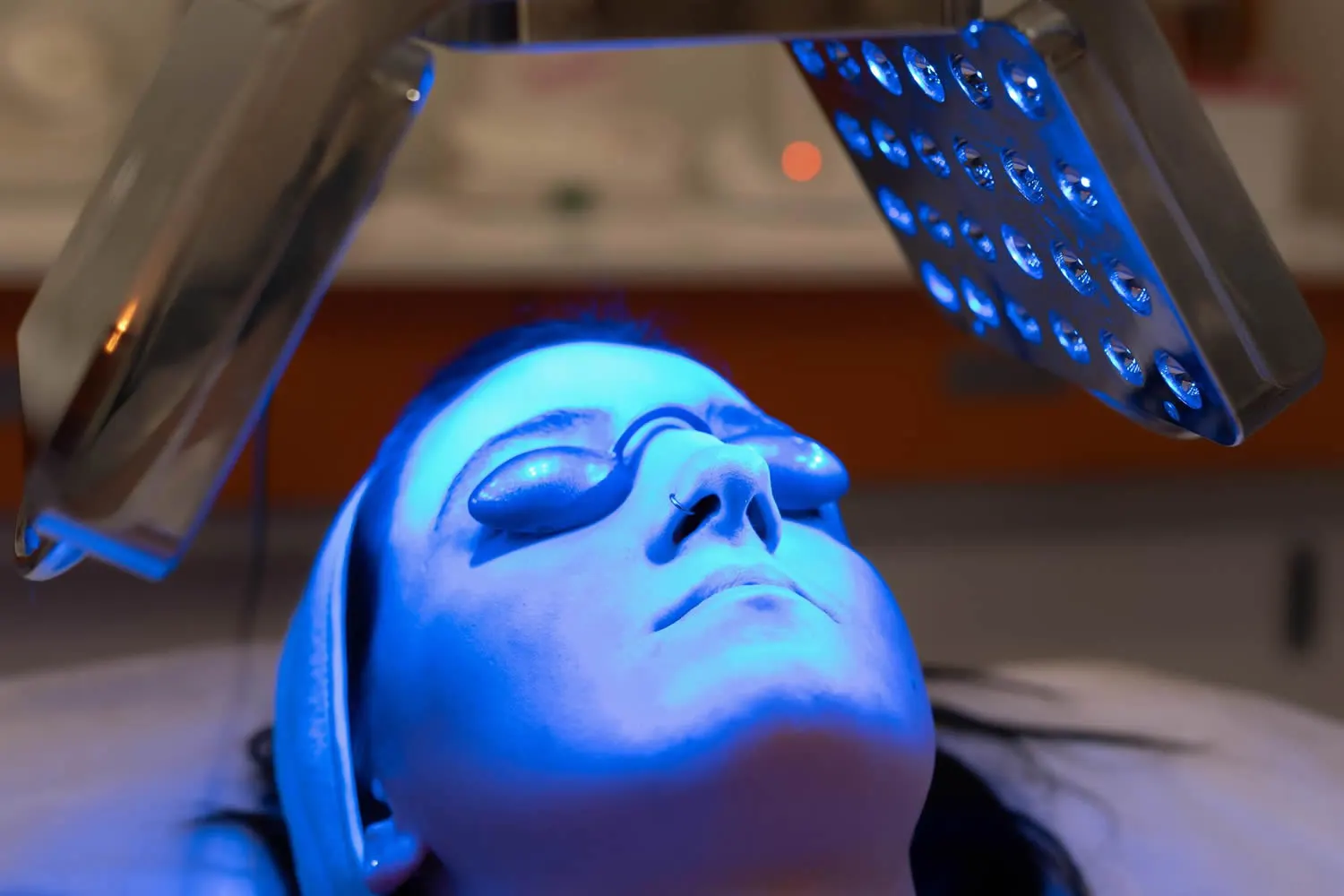 Blue Light Photodynamic treatment in Mesa dermatology